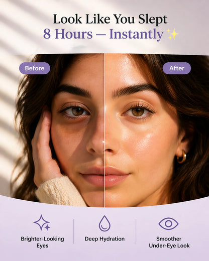Dark Spot Eye Cream - Defeat Eye Bags In Minutes