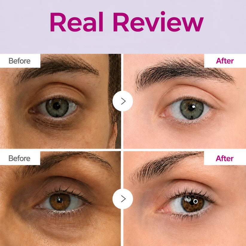 Dark Spot Eye Cream - Defeat Eye Bags In Minutes